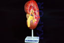 Human Kidney